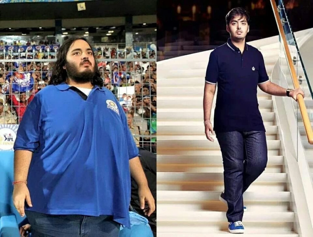 Anant Ambani Health